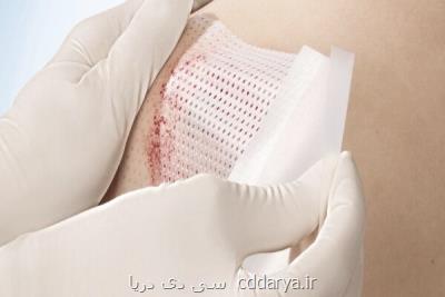 ابداع روشی جدید برای درمان سریع زخم های حاد با کمک محقق ایرانی